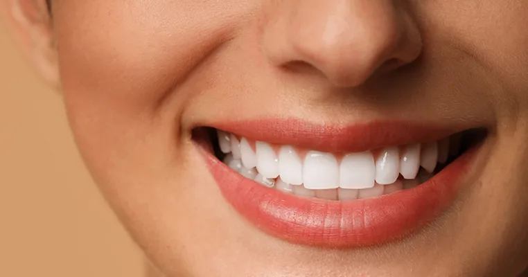 A close-up of a patient's smile