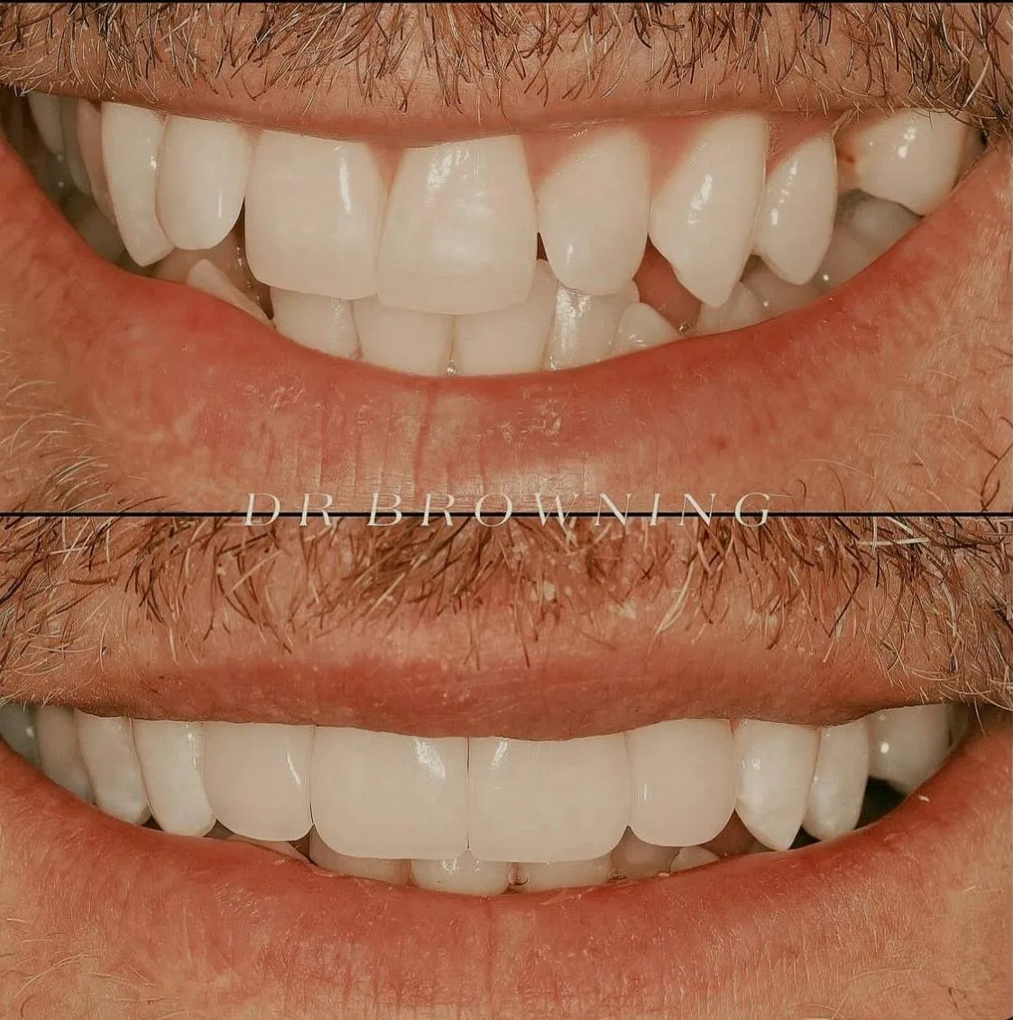 Before & After Case 1