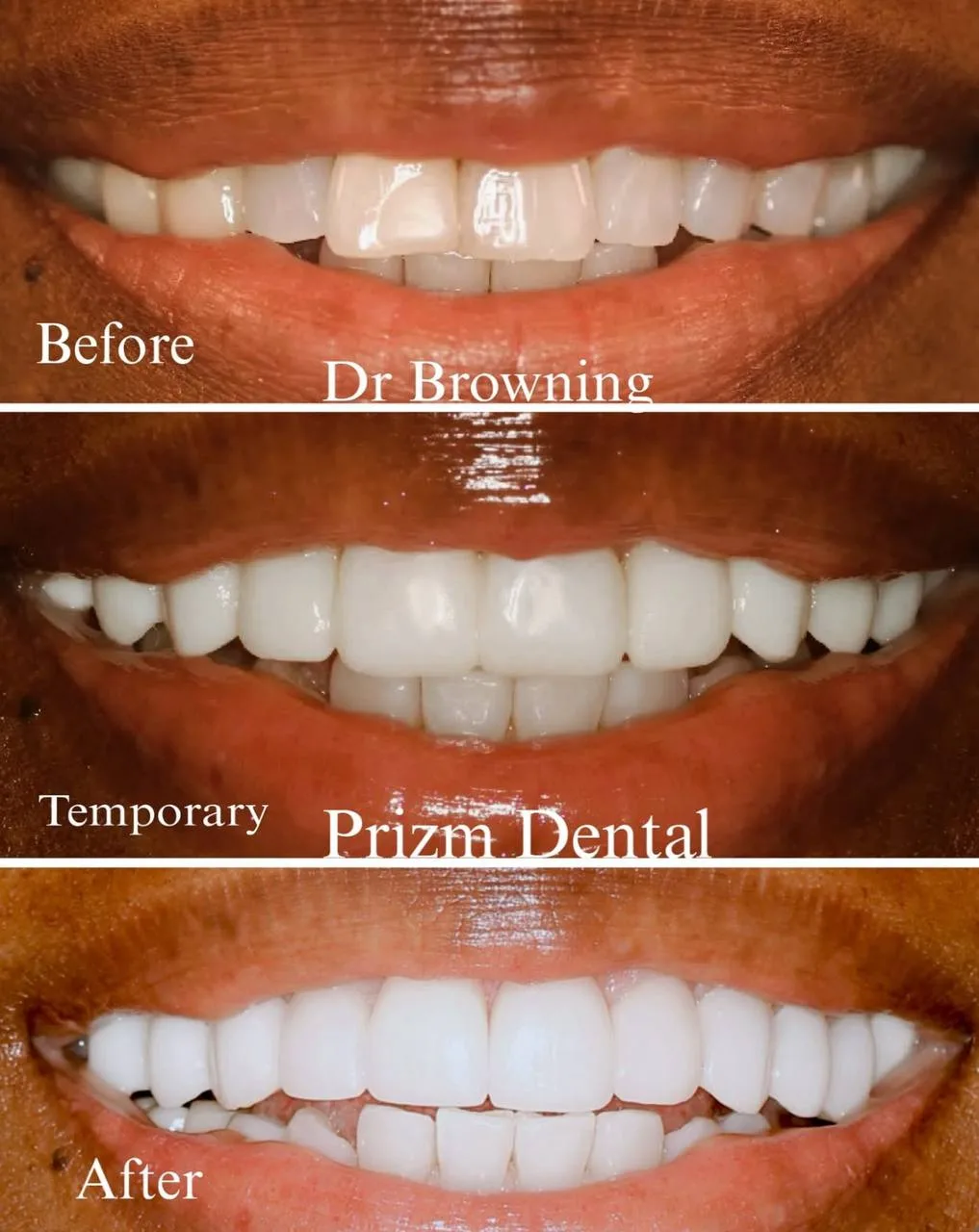 Before & After Case 10