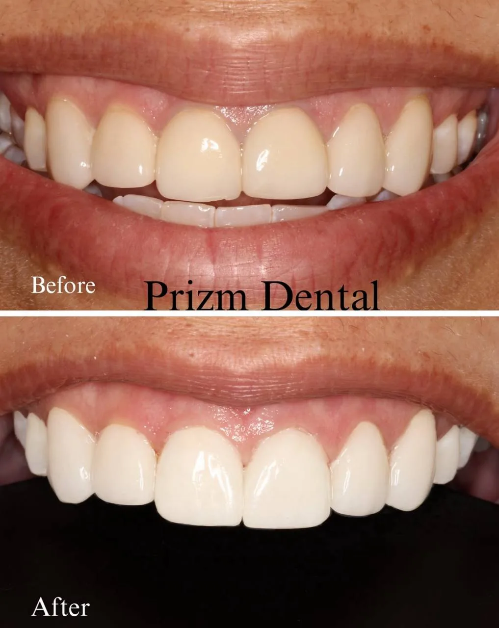 Before & After Case 11