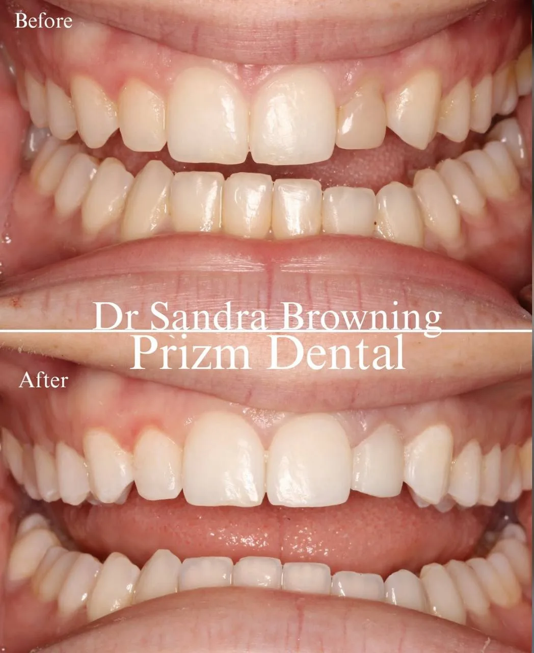 Before & After Case 14