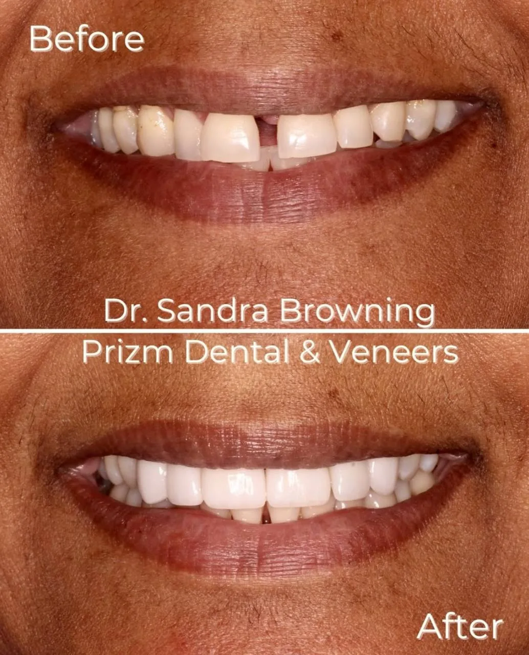 Before & After Case 15