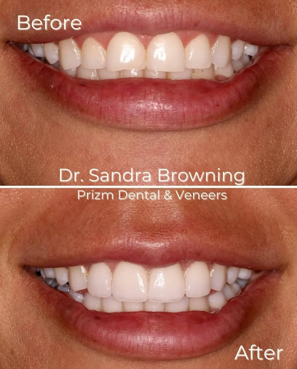 Before & After Case 16
