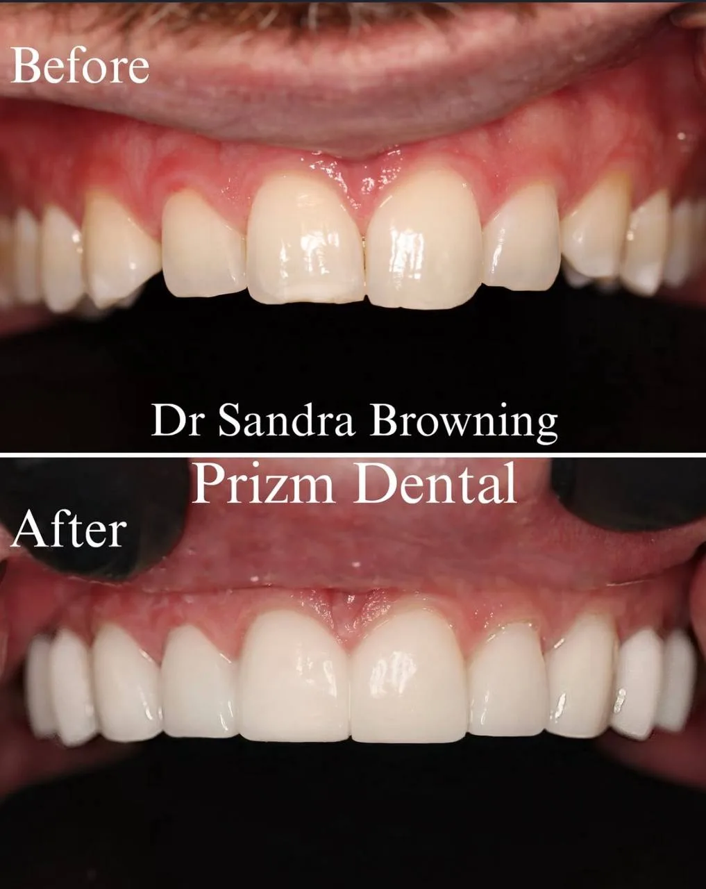Before & After Case 18
