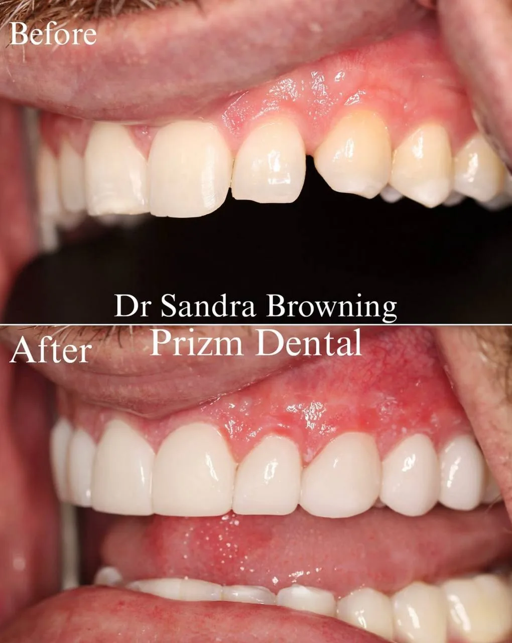 Before & After Case 19