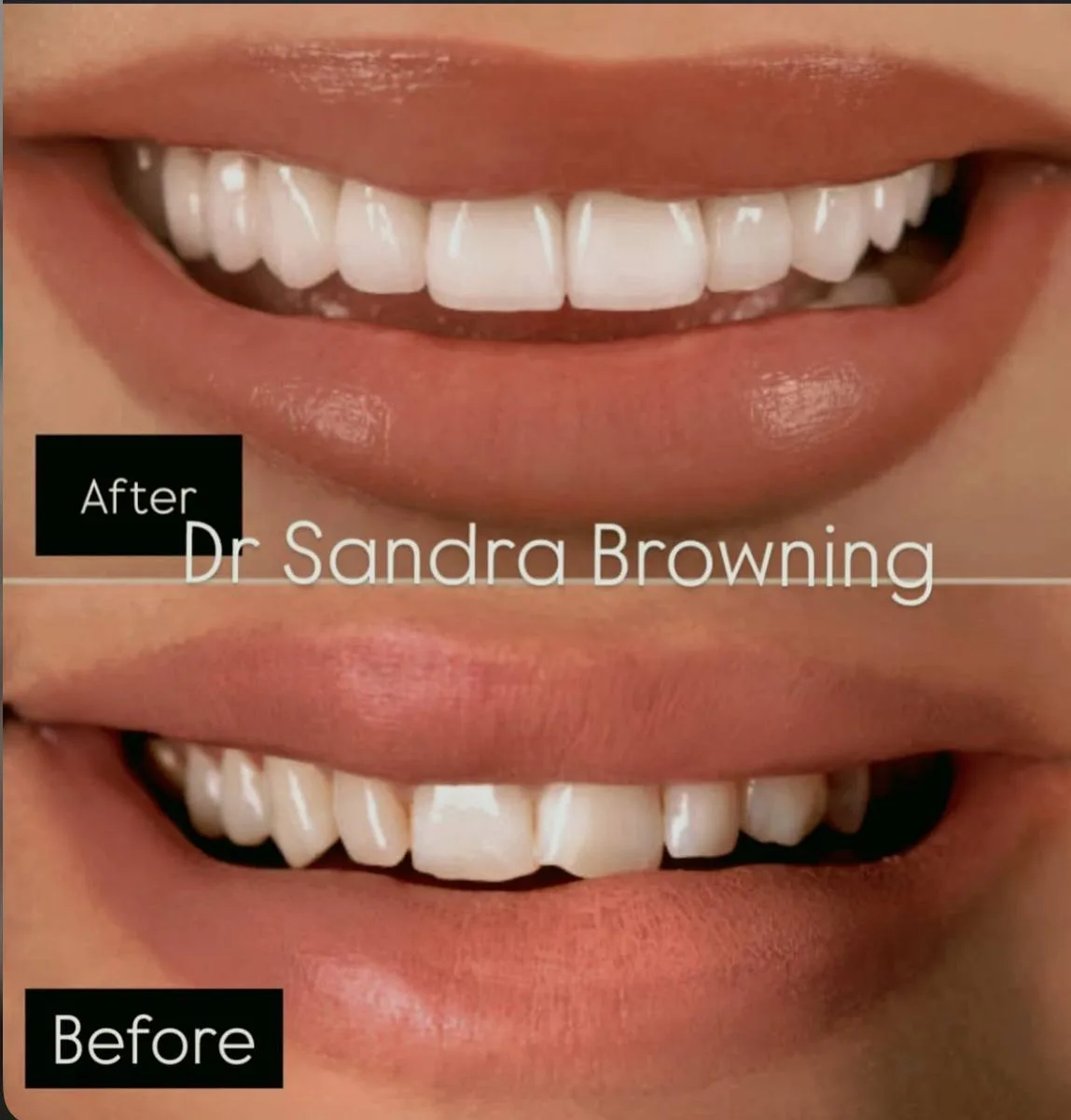 Before & After Case 2