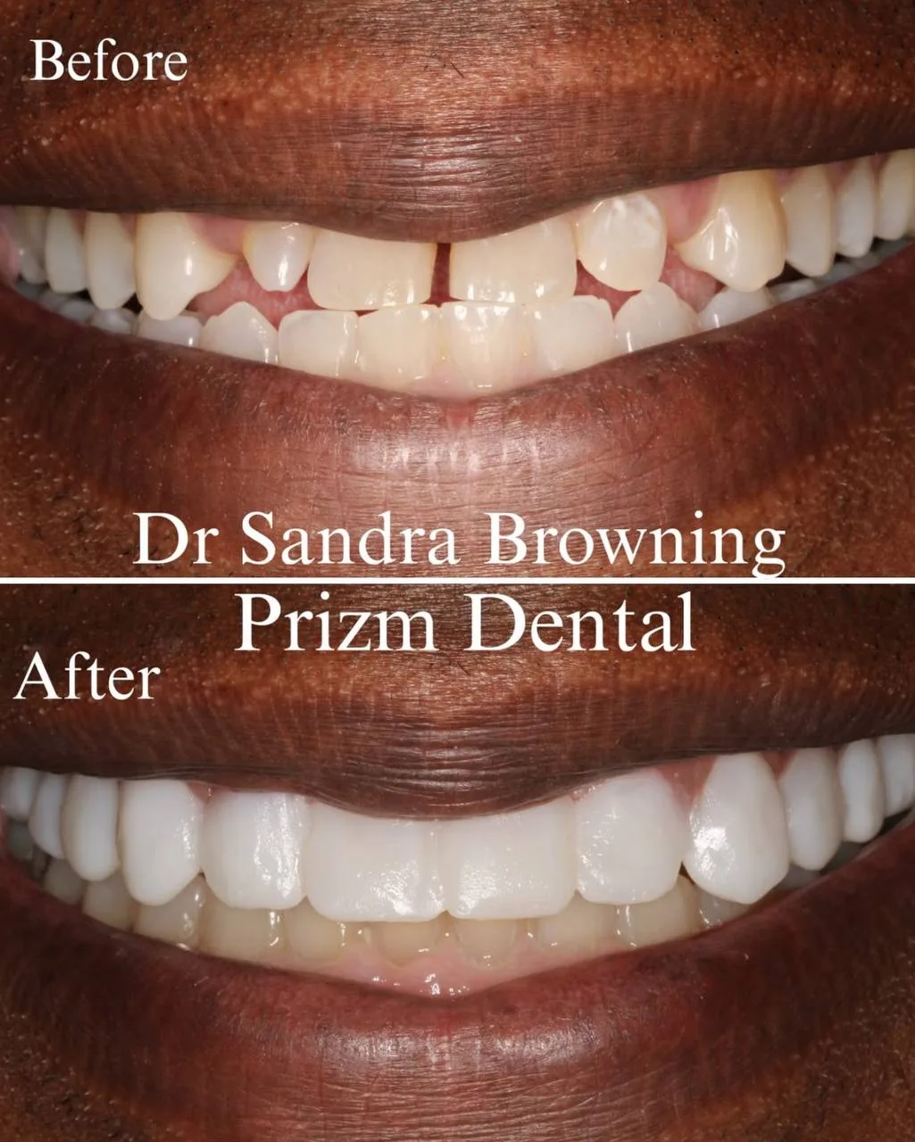 Before & After Case 20