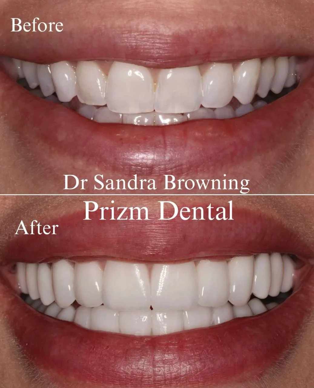 Before & After Case 21