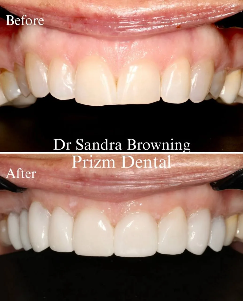 Before & After Case 22