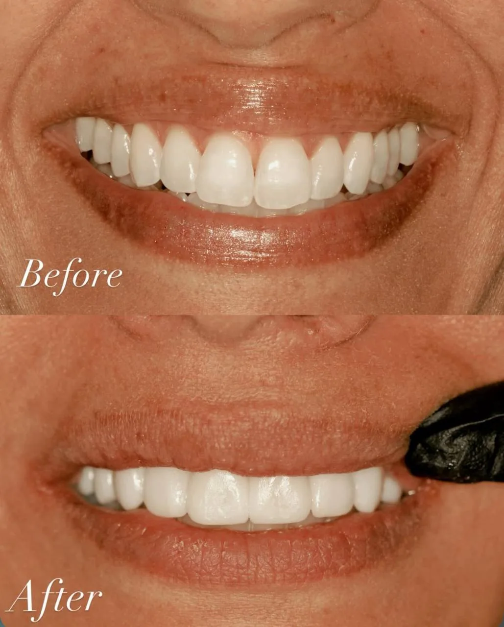 Before & After Case 3