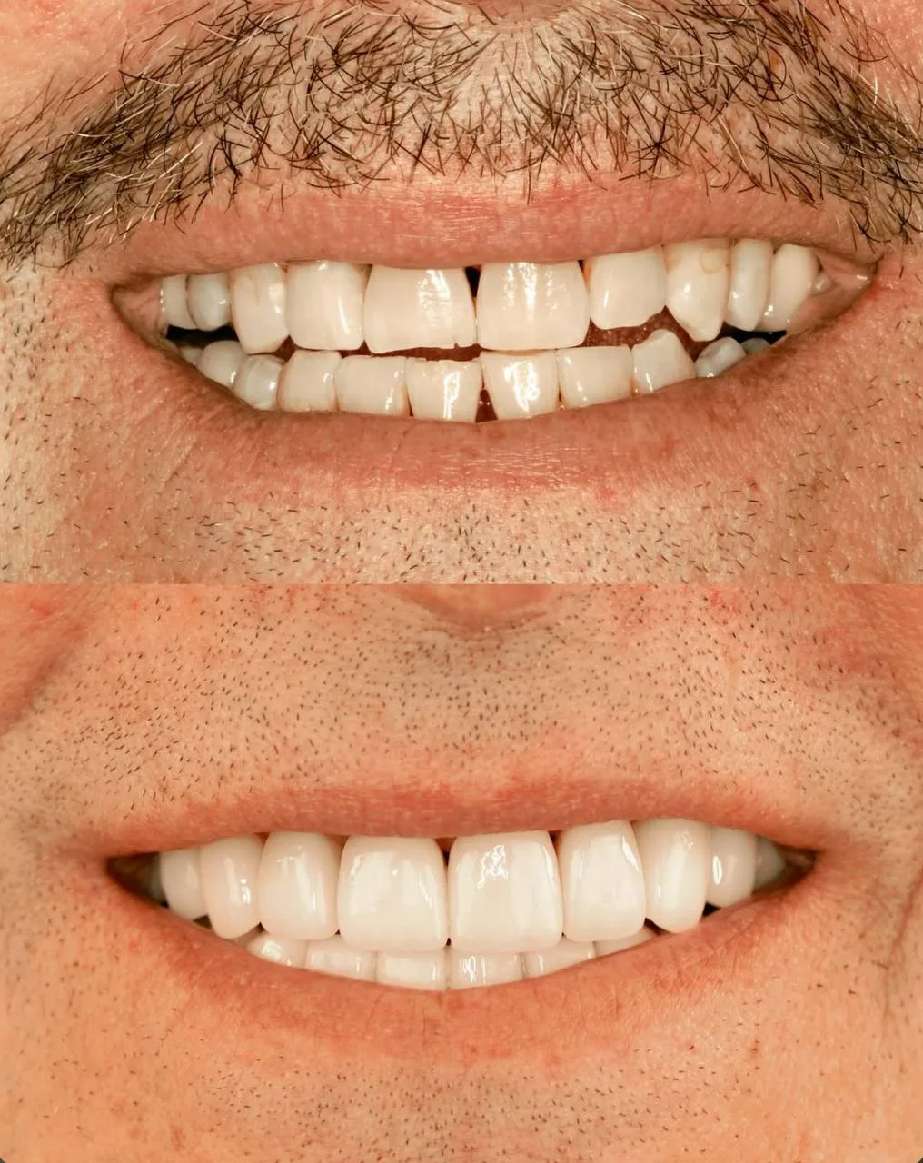 Before & After Case 4