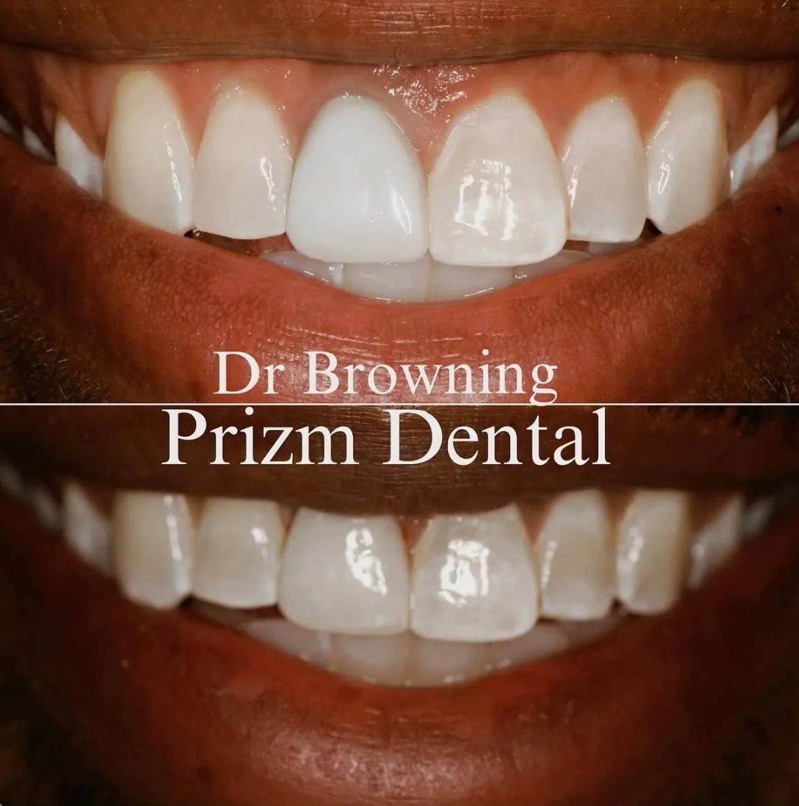 Before & After Case 5