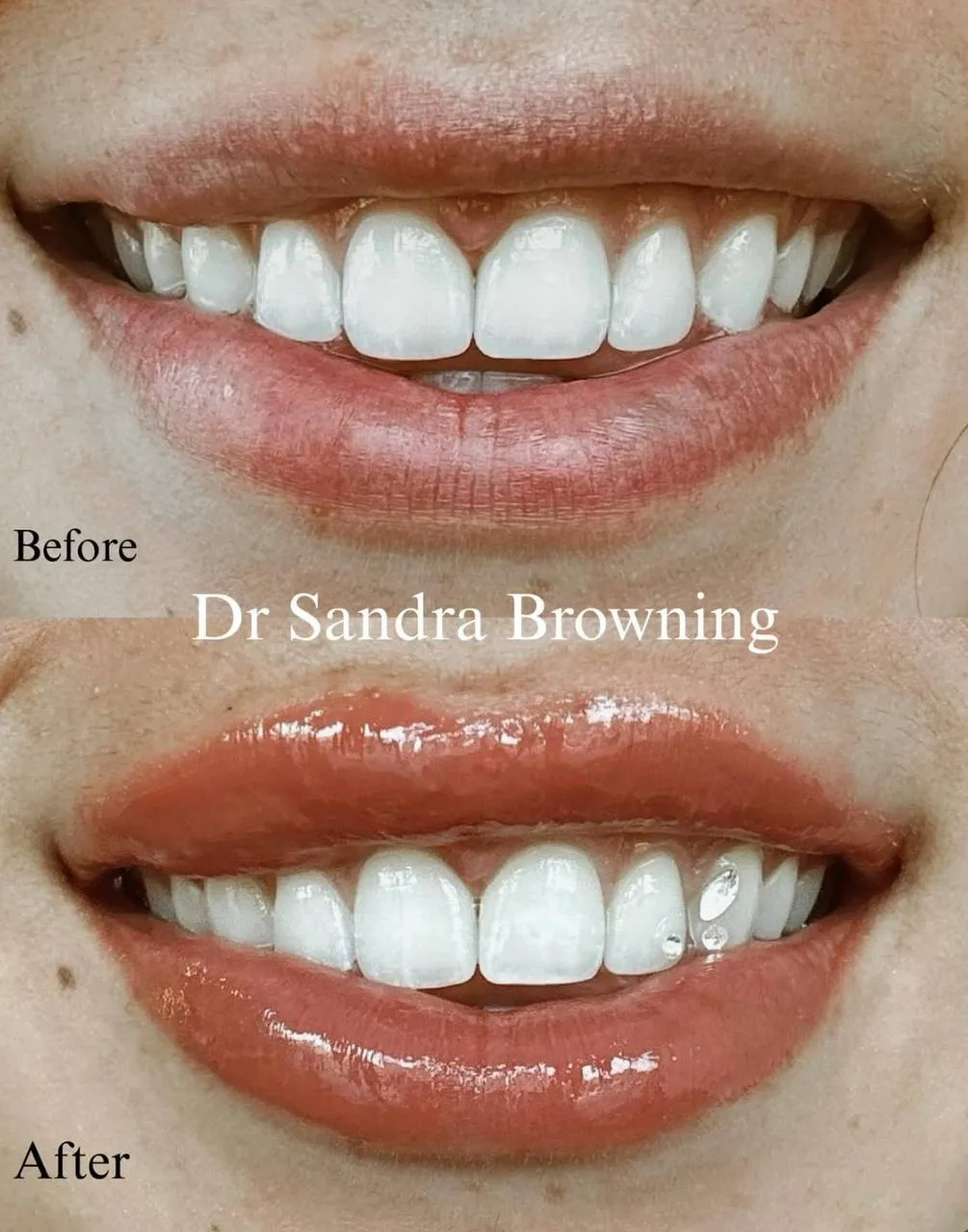 Before & After Case 6