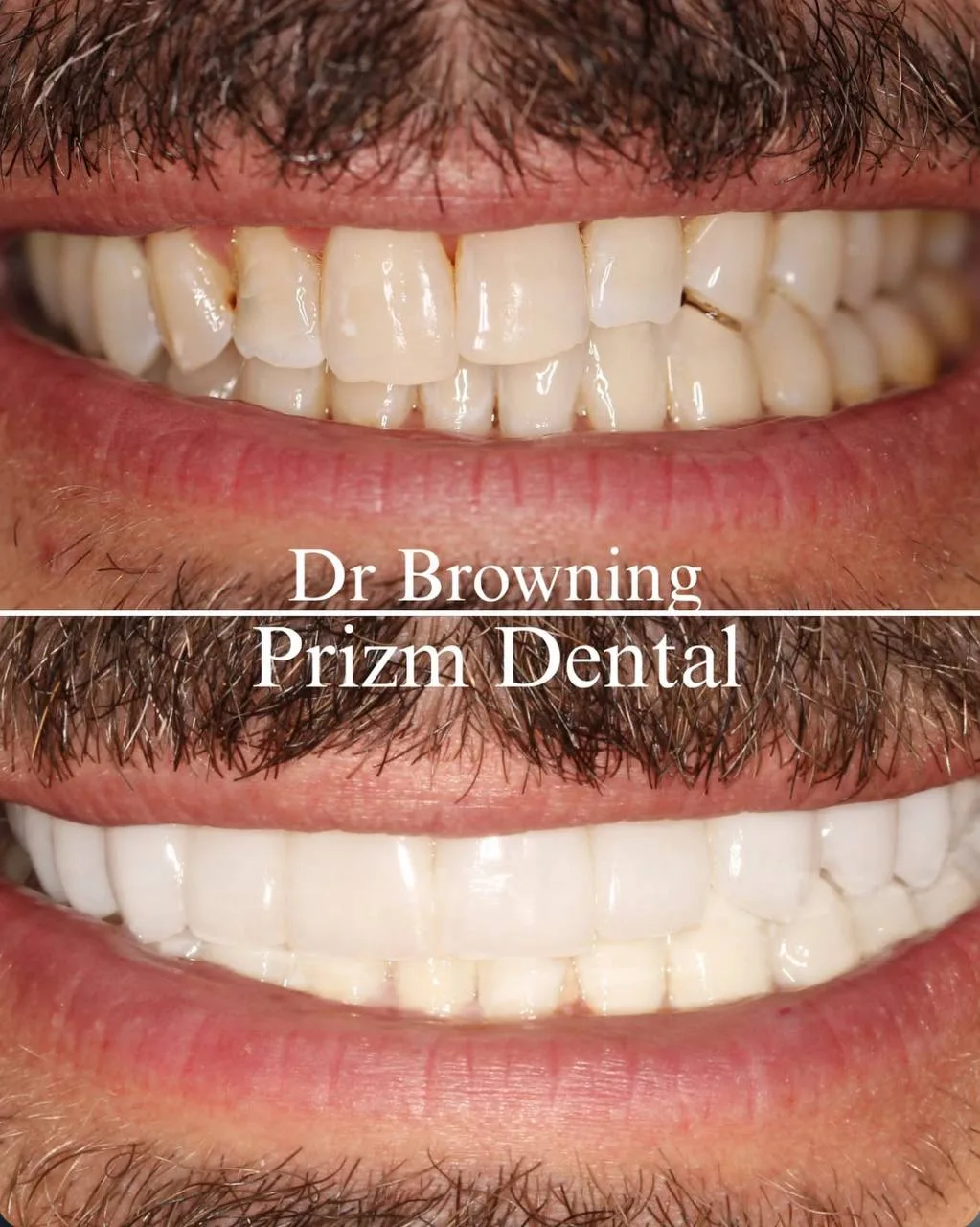 Before & After Case 7