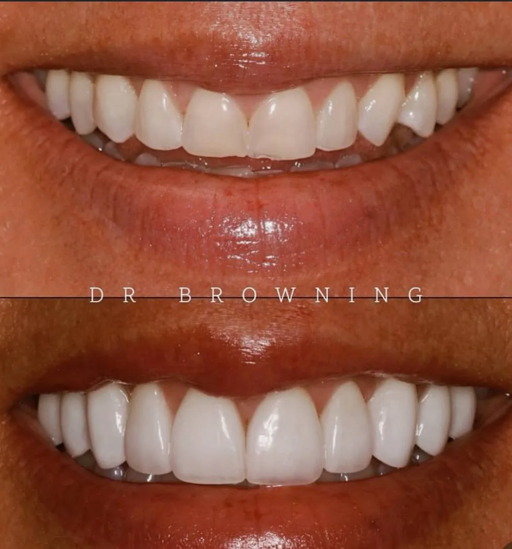 Before & After Case 8